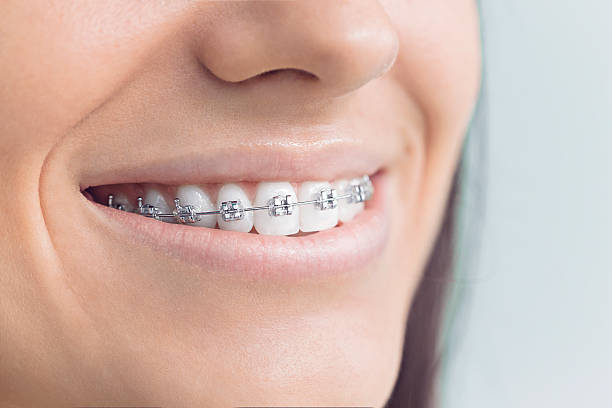 Best Tooth Extraction  in Wheaton, IL